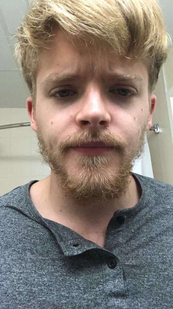 48 Fresh Patchy Beard Styles For Stylish Men - Fashion Hombre