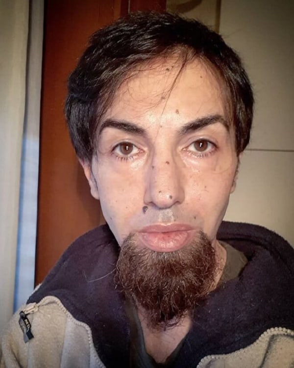 Amish beard styles